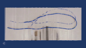 Sac de noeuds 6 _Ecole Charles Perrault - Touffreville la Câble - Mme Langlois