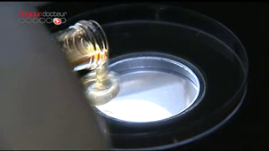 Vidéo 3 : Stimulation ovarienne, insémination artificielle et FIVETE.flv