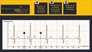 Détermination de la FC - Partie 1