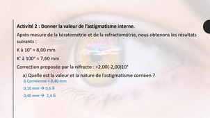 Chapitre 4 - Calcul astigmatisme de l'oeil.mp4